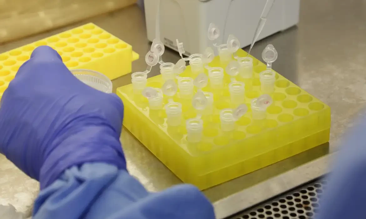 SP confirma segundo caso importado de sarampo