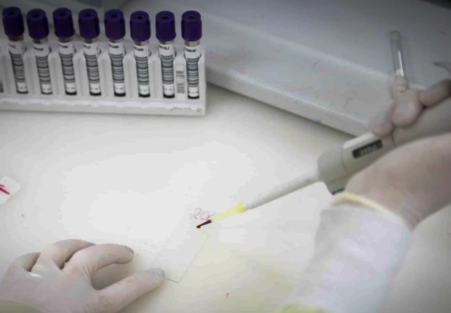 Exames descartam ebola em imigrante da República Democrática do Congo