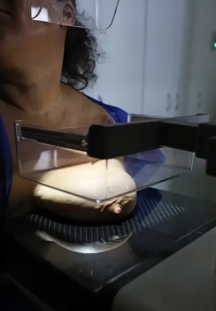 ANS defende que plano cubra mamografia digital sem restrição de idade