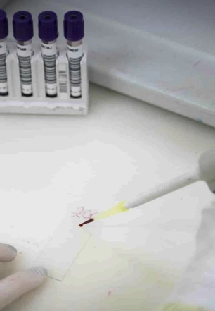 Exames descartam ebola em imigrante da República Democrática do Congo