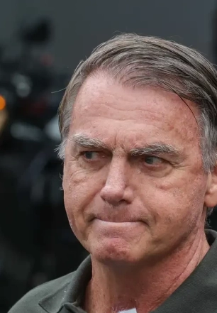PGR dá aval para Bolsonaro fazer cirurgia no ombro