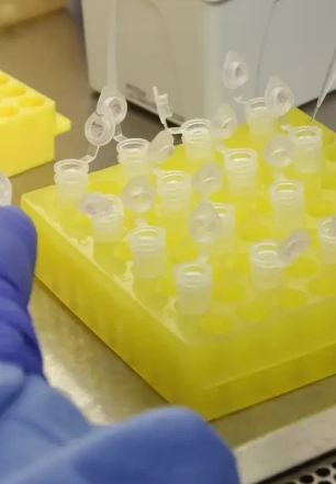 SP confirma segundo caso importado de sarampo