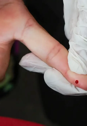 Teste rápido de dengue passa a integrar tabela do SUS