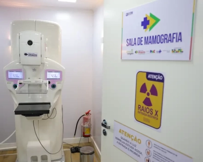 Lei garante mamografia pelo SUS para mulheres a partir dos 40 anos