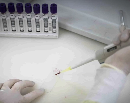 Secretaria de Saúde de SP investiga novo caso suspeito de ebola