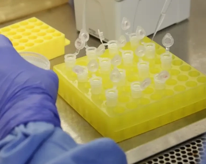 SP confirma segundo caso importado de sarampo